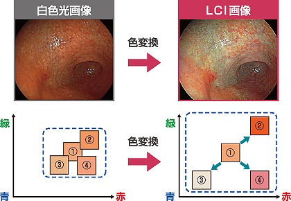 LCI（Linked Color Imaging）